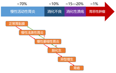 胃铋镁颗粒在幽门螺杆菌感染中的应用